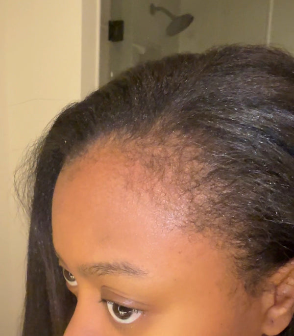 Before transformation