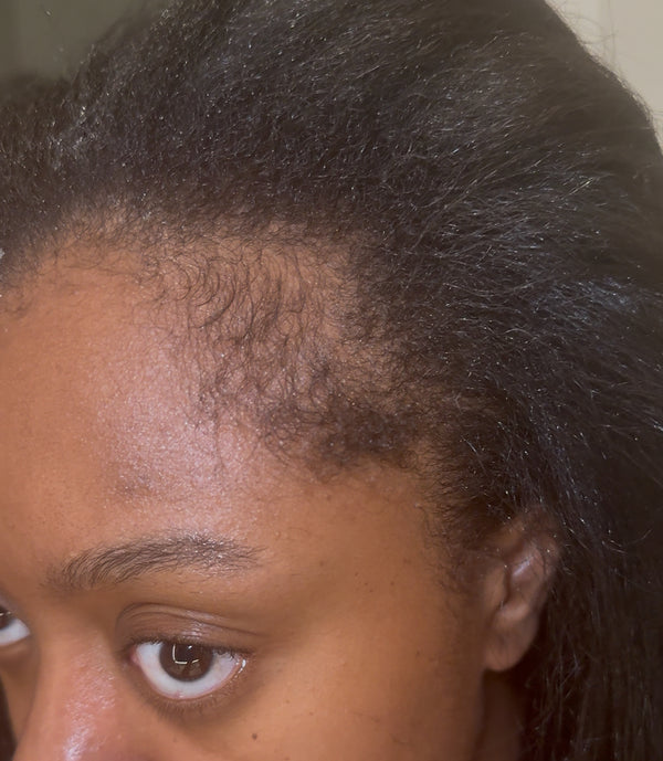 After transformation